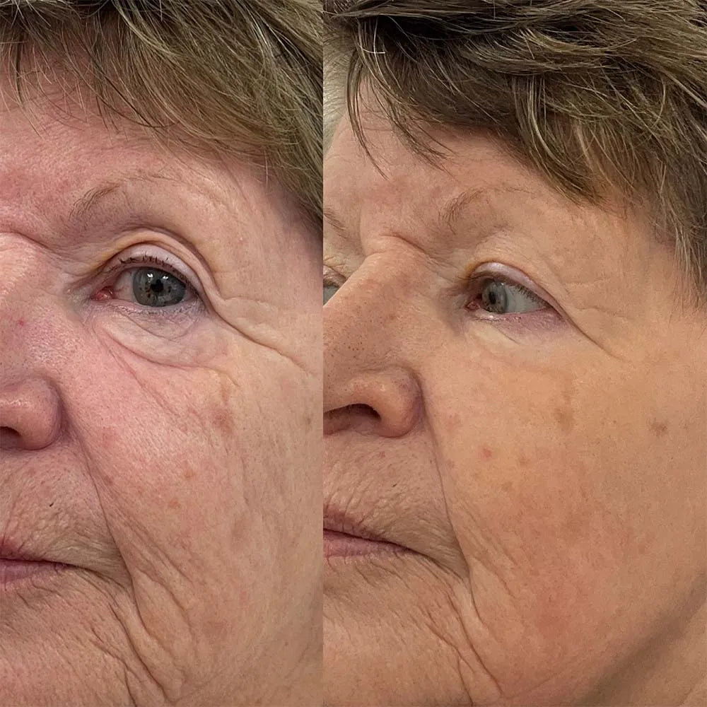 Korean Wrinkle Bounce Multi Balm Stick